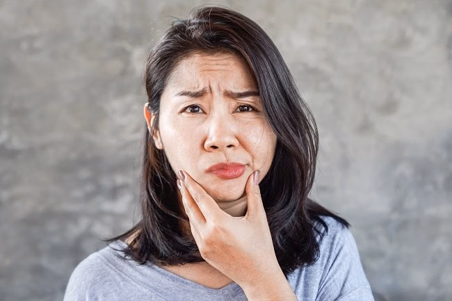 Bell Palsy