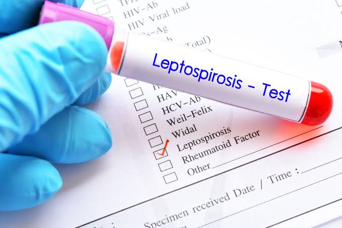 Leptospirosis Akut