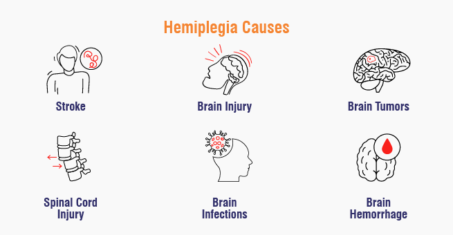 Hemiplegia