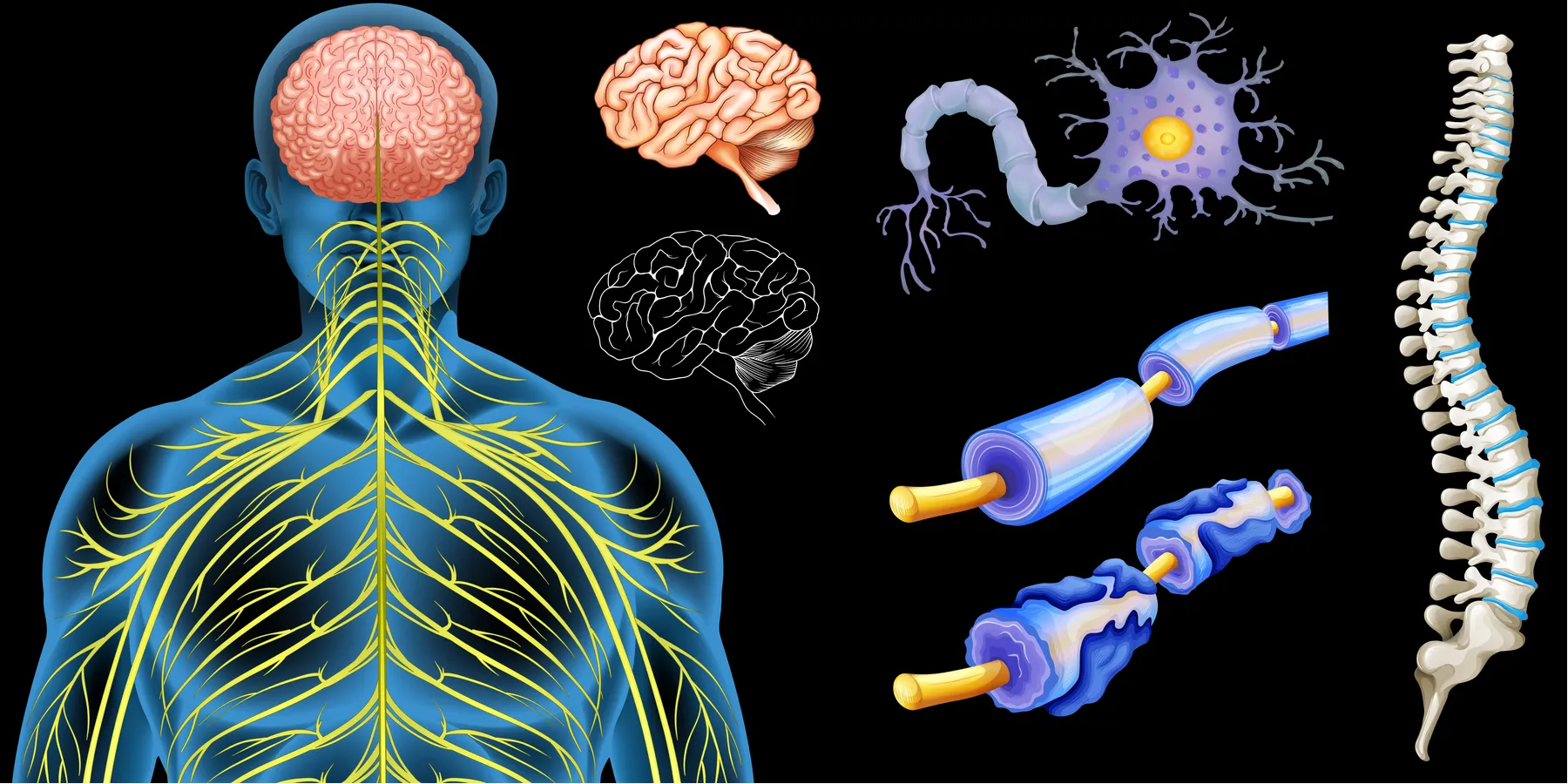 Sclerosis