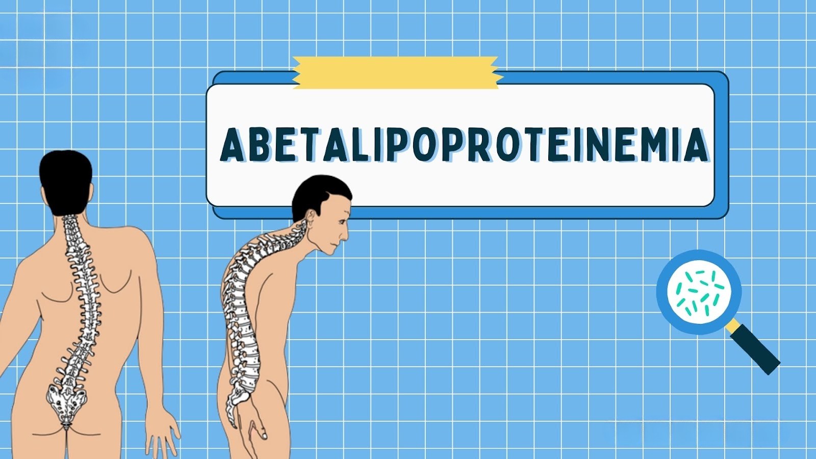 Abetalipoproteinemia